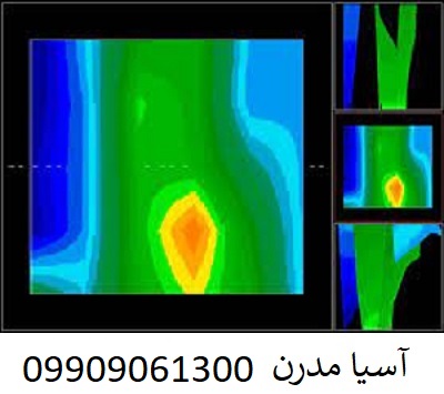 فلزیاب FULL SENSOR TURBO 18000